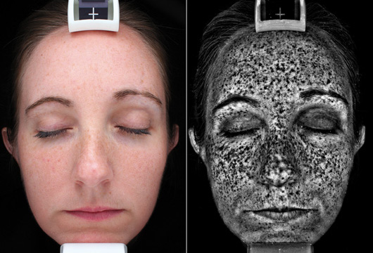 skin scan uv damagex skin scan uv damagex